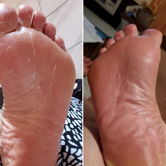 Veloma Antisvamptvål