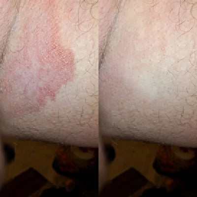 Veloma Antisvamptvål